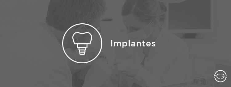 Implantes