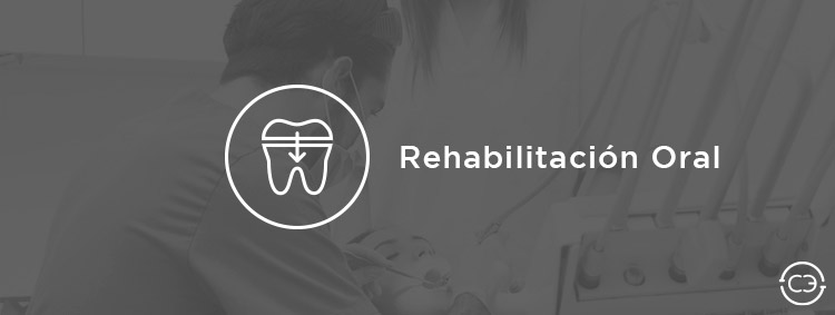 Rehabilitación Oral