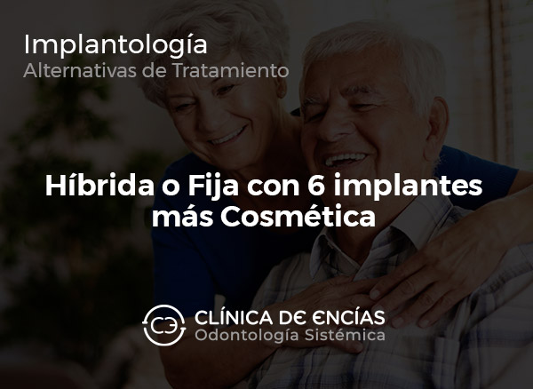 Híbrida o Fija con 6 implantes más Cosmética