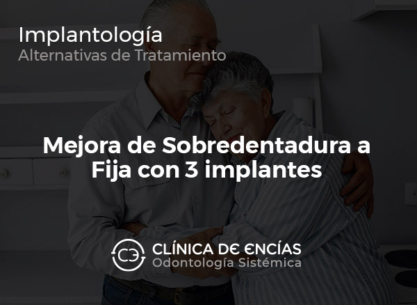 Mejorar Sobredentadura a Puente Fijo con 3 implantes
