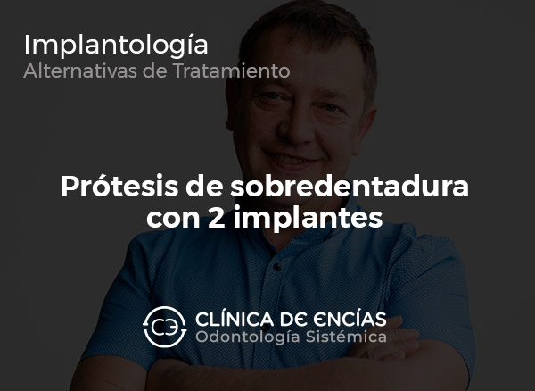 Prótesis de sobredentadura con 2 Implantes
