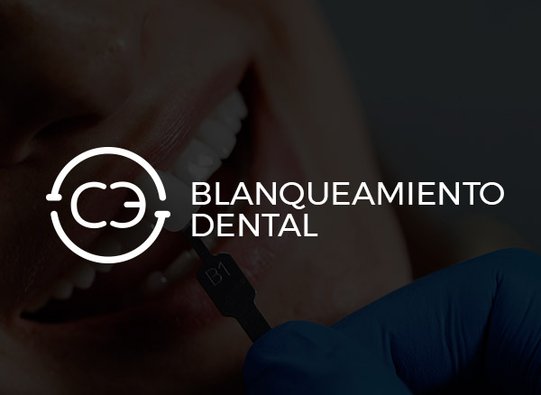 Blanqueamiento Dental
