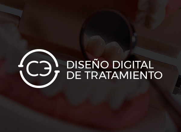 Diseño Digital de Tratamiento