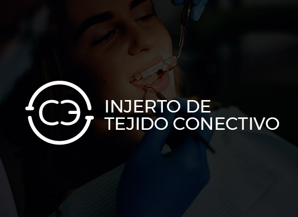 Injerto Tejido Conectivo